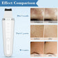 ClearLuxe™ ANLAN Ultrasonic Skin Scrubber: Deep Clean, Heat, EMS Lift, Skin Care.